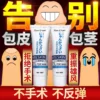 Male [foreskin bane] has been to long sensitive treatment of ring foreskin prepuce gel stick stapling orthotics