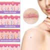 WOOKINGWA Silicone Scar Sheets - 1.6” x 120” Roll, Medical Grade Scar Tape, Non-Irritating Scar Removal Strips for Surgical Scars, Keloid, C-Section, Tummy Tuck, Burn, Acne