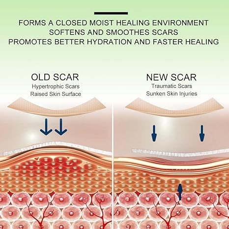 Silicone Scar Sheets(1.8” x 157”Inch- 4M), Scar Away Scar Tape, Scar Strips, Reusable, Professional Scar Removal Sheets for C-Section, Surgery, Burn, Keloid, Acne et, Scar Patch. - Image 3
