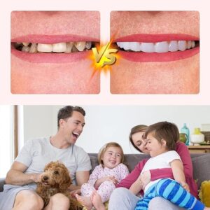 ake Teeth, 4PCS Temporary Fake Teeth for Women and Men, Nature and Comfortable 03