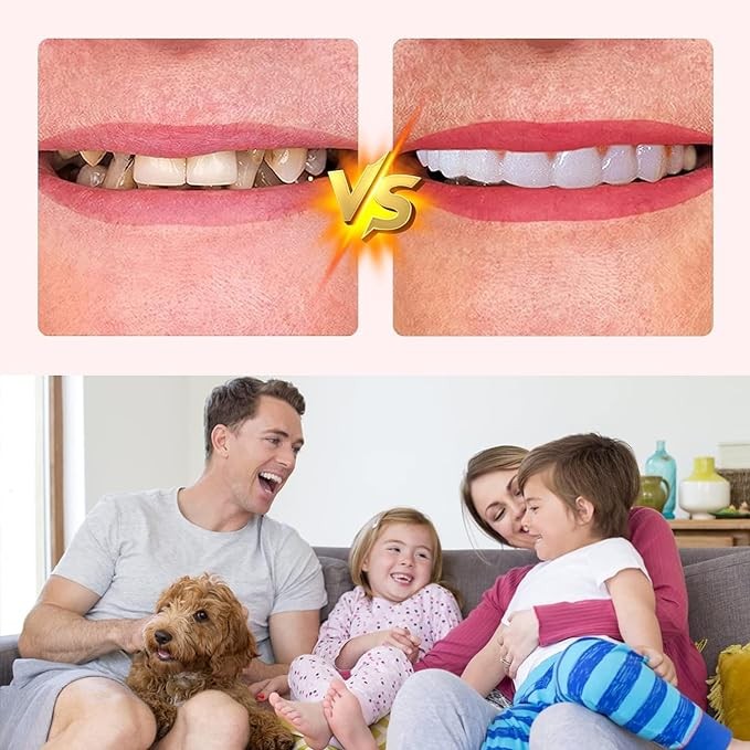 ake Teeth, 4PCS Temporary Fake Teeth for Women and Men, Nature and Comfortable 03 - Image 2